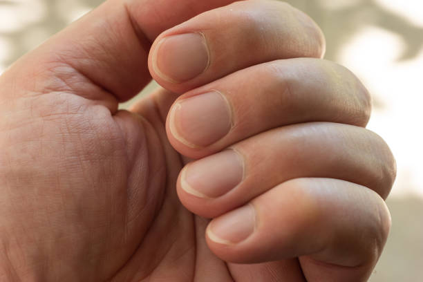 Mens Nail Length