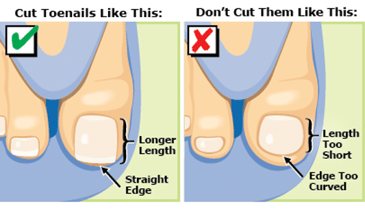 Toenail Length