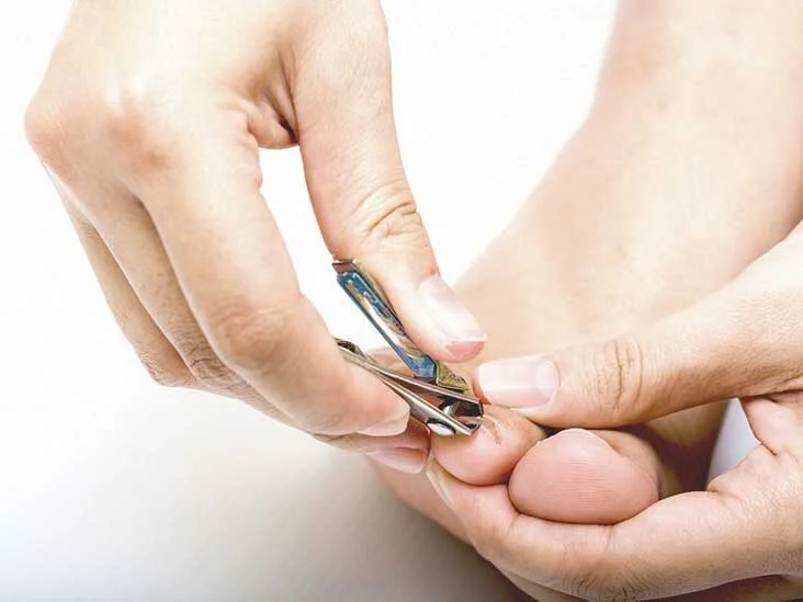 What Causes Thick Toenails